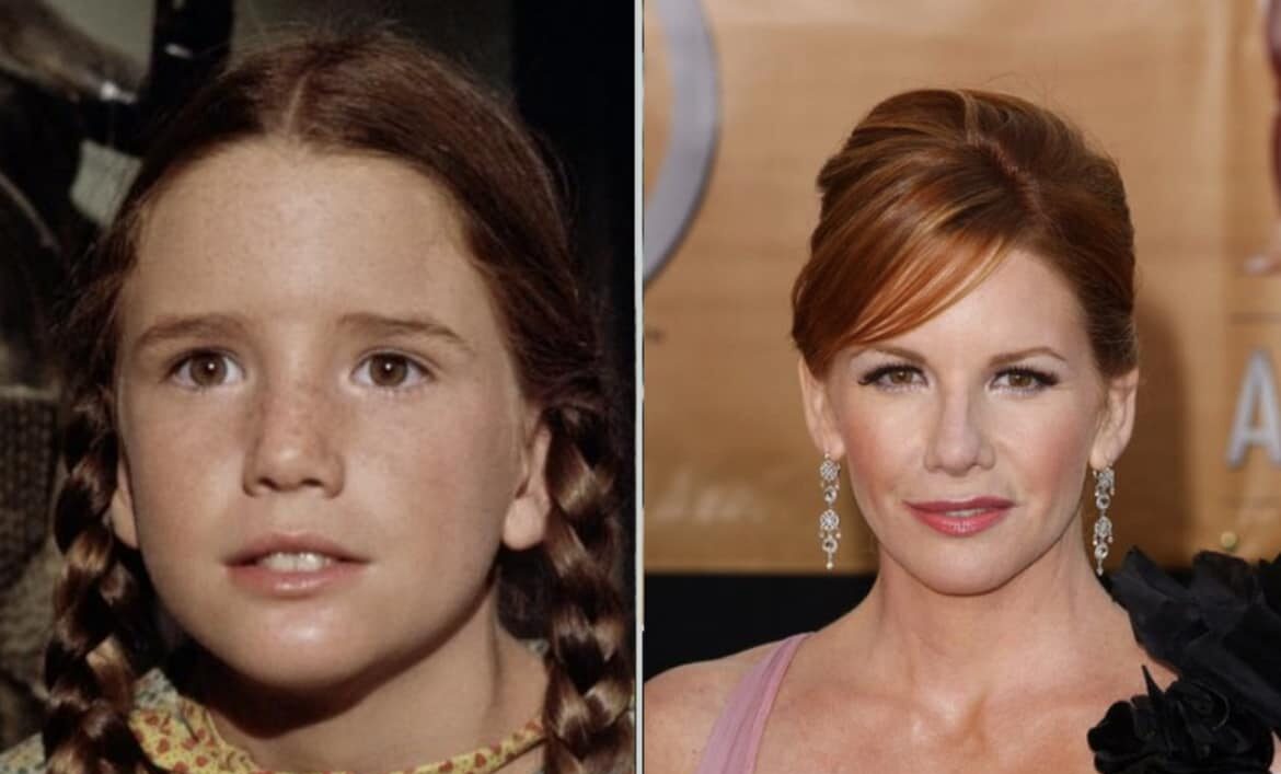 Melissa Gilbert’s Natural Beauty: Botox and Implant-Free