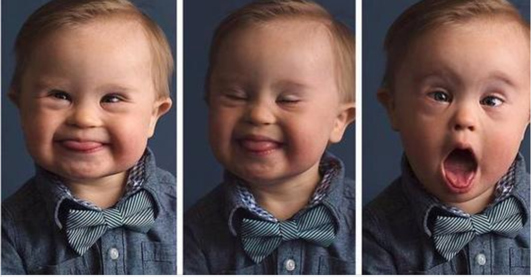 Agency refuses to let boy with Down syndrome model their clothes