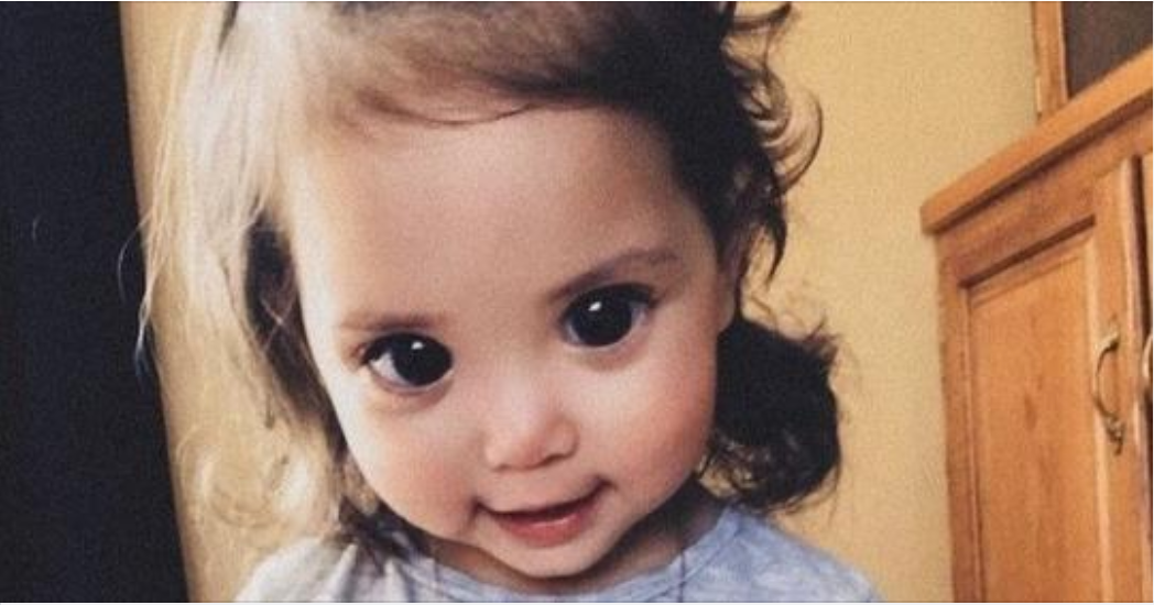 Born with the biggest eyes! This is what a girl born with huge eyes looks like years later