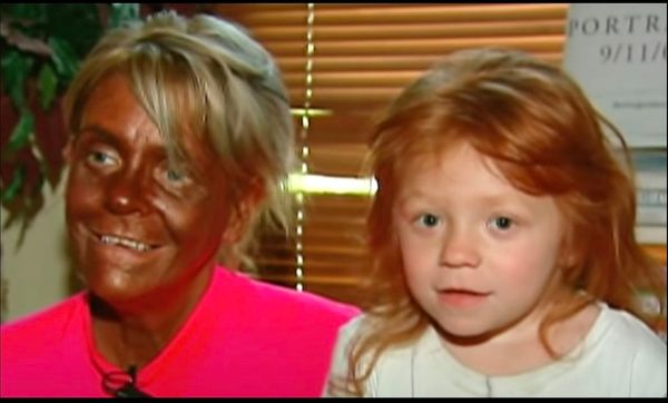 Patricia Krentcil tanned five days a week and almost lost her life – this is what “Tan Mom” looks like today