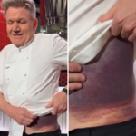 Gordon Ramsay shares important message after potentially fatal accident